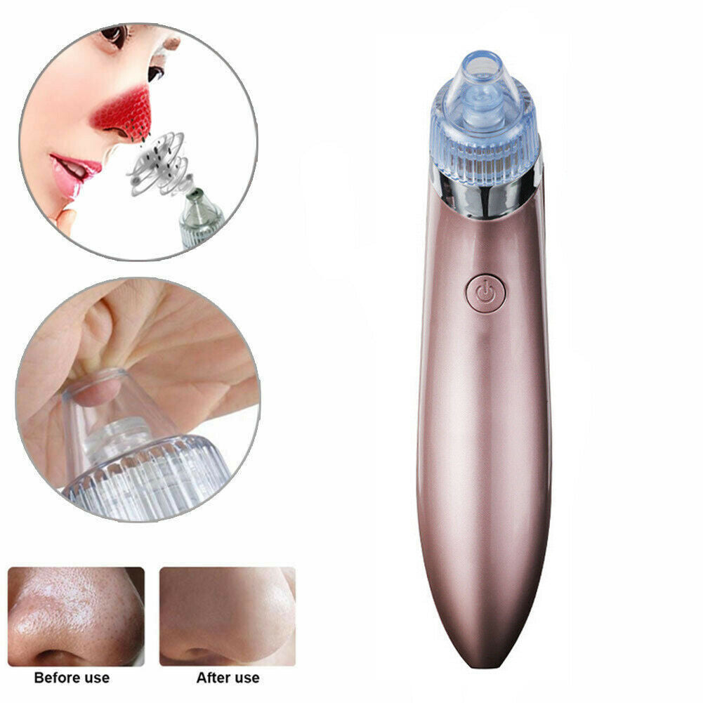 Electric Blackhead Vacuum Pore Cleaner - Acne & Pimple Remover with Strong Suction, Diamond Dermabrasion, USB Rechargeable Face Cleaner