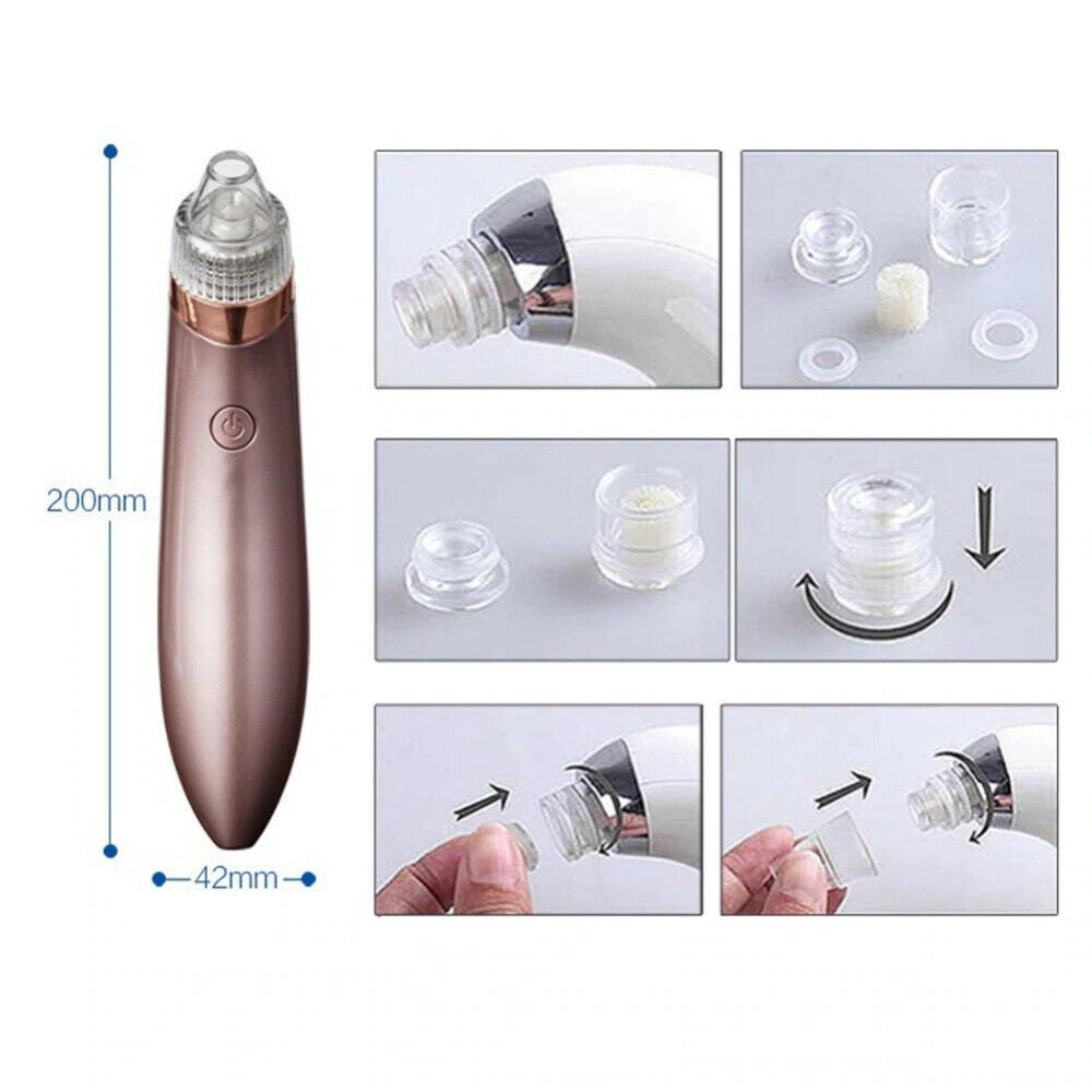Electric Blackhead Vacuum Pore Cleaner - Acne & Pimple Remover with Strong Suction, Diamond Dermabrasion, USB Rechargeable Face Cleaner