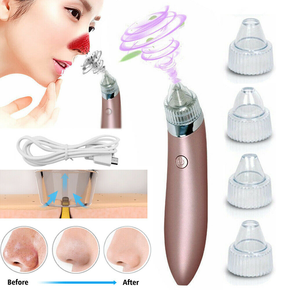 Electric Blackhead Vacuum Pore Cleaner - Acne & Pimple Remover with Strong Suction, Diamond Dermabrasion, USB Rechargeable Face Cleaner