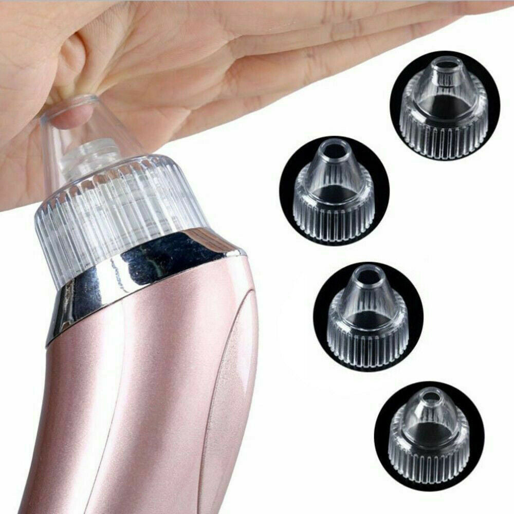 Electric Blackhead Vacuum Pore Cleaner - Acne & Pimple Remover with Strong Suction, Diamond Dermabrasion, USB Rechargeable Face Cleaner