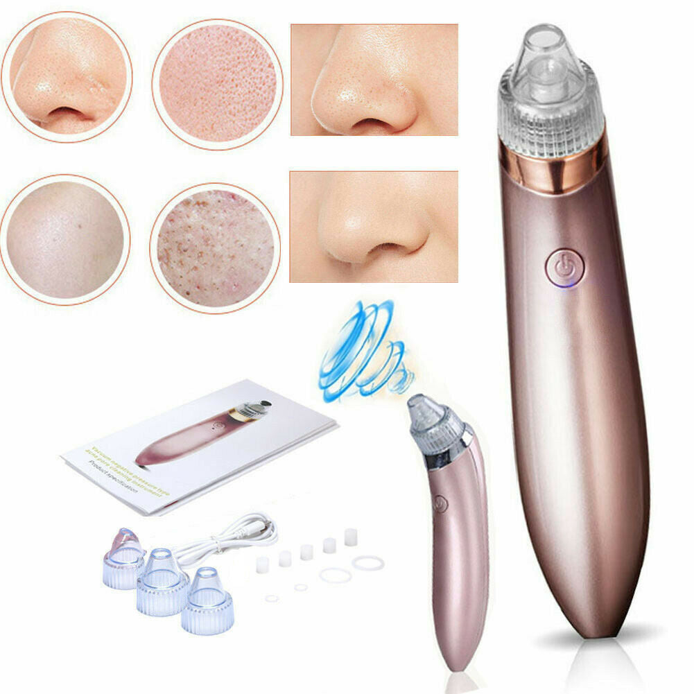 Electric Blackhead Vacuum Pore Cleaner - Acne & Pimple Remover with Strong Suction, Diamond Dermabrasion, USB Rechargeable Face Cleaner